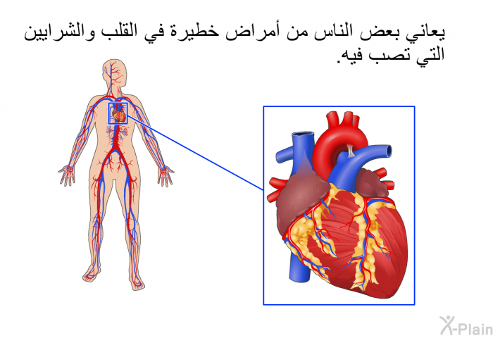 يعاني بعض الناس من أمراض خطيرة في القلب والشرايين التي تصب فيه.
