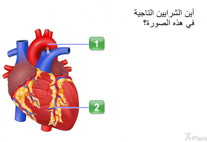 أين الشرايين التاجية في هذه الصورة؟