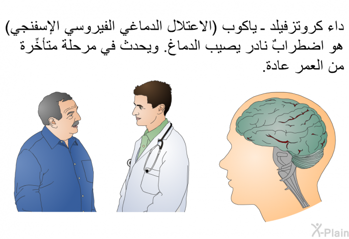 داء كروتزفيلد ـ ياكوب (الاعتلال الدماغي الفيروسي الإسفنجي) هو اضطرابٌ نادر يصيب الدماغ. ويحدث في مرحلة متأخِّرة من العمر عادة.