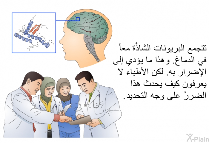 تتجمع البريونات الشاذَّة معاً في الدماغ. وهذا ما يؤدي إلى الإضرار به. لكن الأطباء لا يعرفون كيف يحدث هذا الضررُ على وجه التحديد.