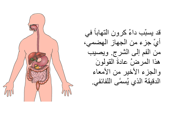 قد يسبب داءُ كرون التهاباً في أي جزء من الجهاز الهضمي، من الفم إلى الشرج. ويصيب هذا المرضُ عادةً القولون والجزء الأخير من الأمعاء الدقيقة الذي يُسمى اللفائفي.