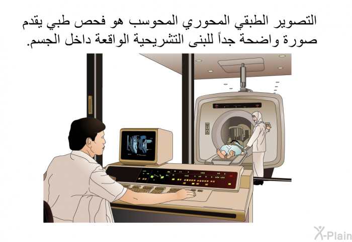 التصوير الطبقي المحوري المحوسب هو فحص طبي يقدم صورة واضحة جداً للبنى التشريحية الواقعة داخل الجسم.