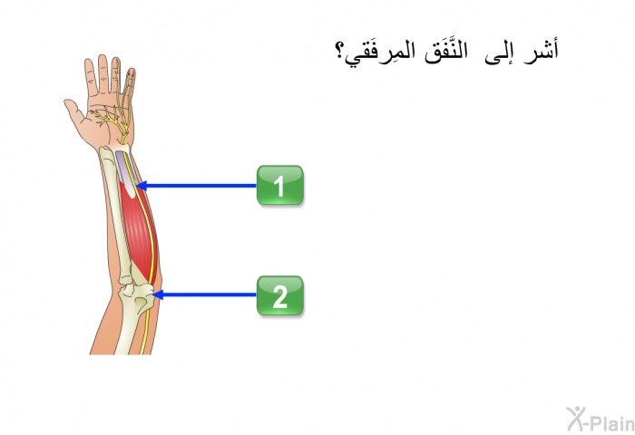 أشر إلى النَّفَق المِرفَقي؟