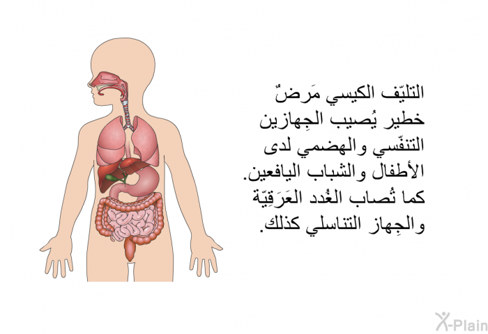 التليّف الكيسي مَرضٌ خطير يُصيب الجِهازين التنفّسي والهضمي لدى الأطفال والشباب اليافعين. كما تُصاب الغُدد العَرَقِيّة والجِهاز التناسلي كذلك.