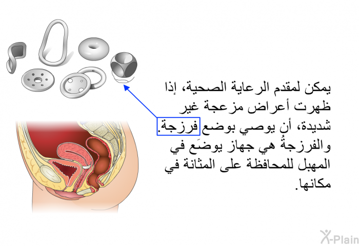 يمكن لمقدم الرعاية الصحية، إذا ظهرت أعراض مزعجة غير شديدة، أن يوصي بوضع فرزجة. والفرزجةُ هي جهاز يوضَع في المهبل للمحافظة على المثانة في مكانها.