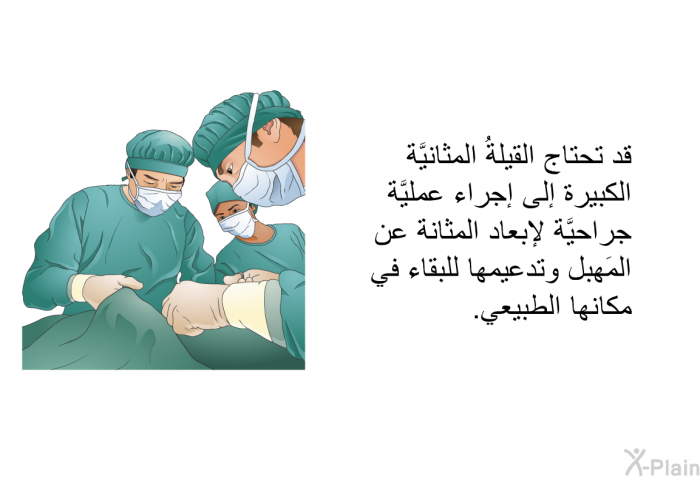 قد تحتاج القيلةُ المثانيَّة الكبيرة إلى إجراء عمليَّة جراحيَّة لإبعاد المثانة عن المَهبِل وتدعيمها للبقاء في مكانها الطبيعي.