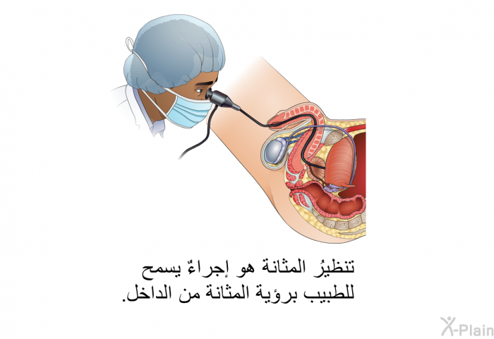 تنظيرُ المثانة هو إجراءٌ يسمح للطبيب برؤية المثانة من الداخل.