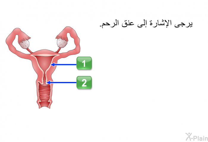 يرجى الإشارة إلى عنق الرحم.