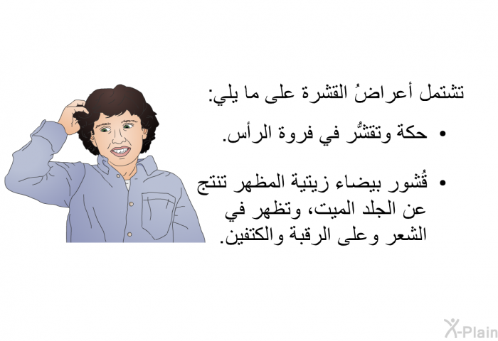 تشتمل أعراضُ القشرة على ما يلي:   حكة وتقشُّر في فروة الرأس.  قُشور بيضاء زيتية المظهر تنتج عن الجلد الميت، وتظهر في الشعر وعلى الرقبة والكتفين.