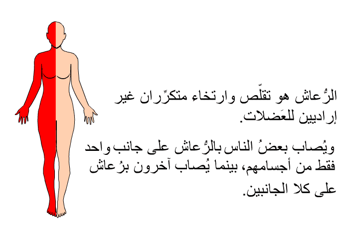 الرُّعاش هو تقلّص وارتخاء متكرِّران غير إراديين للعَضلات. ويُصاب بعضُ الناس بالرُّعاش على جانب واحد فقط من أجسامهم، بينما يُصاب آخرون برُعاش على كلا الجانبين.