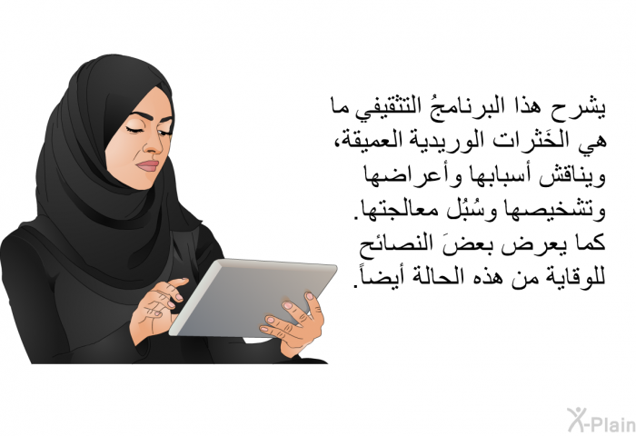 تشرح هذه المعلومات الصحية ما هي الخَثرات الوريدية العميقة، وتناقش أسبابها وأعراضها وتشخيصها وسُبُل معالجتها. كما تعرض بعضَ النصائح للوقاية من هذه الحالة أيضاً.