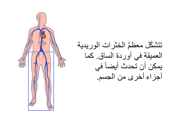 تتشكَّل معظمُ الخَثرات الوريدية العميقة في أوردة الساق. كما يمكن أن تحدث أيضاً في أجزاء أخرى من الجسم.