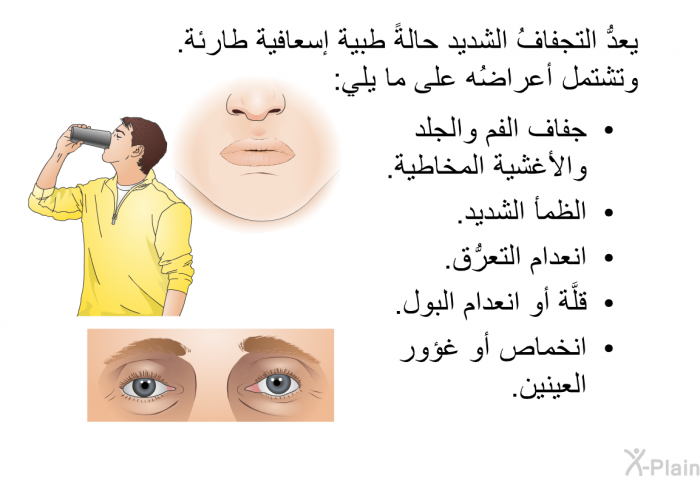 يعدُّ التجفافُ الشديد حالةً طبية إسعافية طارئة. وتشتمل أعراضُه على ما يلي:   جفاف الفم والجلد والأغشية المخاطية.  الظمأ الشديد.  انعدام التعرُّق.  قلَّة أو انعدام البول.  انخماص أو غؤور العينين.