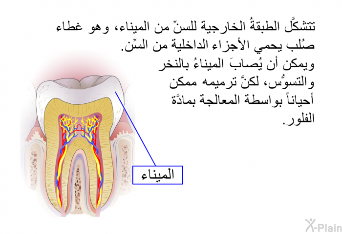 تتشكَّل الطبقةُ الخارجية للسنِّ من الميناء، وهو غطاءٌ صُلب يحمي الأجزاء الداخلية من السِّن. ويمكن أن يُصابَ الميناءُ بالنخر والتسوُّس، لكنَّ ترميمه ممكن أحياناً بواسطة المعالجة بمادَّة الفلور.