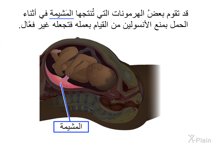 قد تقوم بعضُ الهرمونات التي تُنتجها المَشيمة في أثناء الحمل بمنع الأنسولين من القيام بعمله فتجعله غير فعَّال.