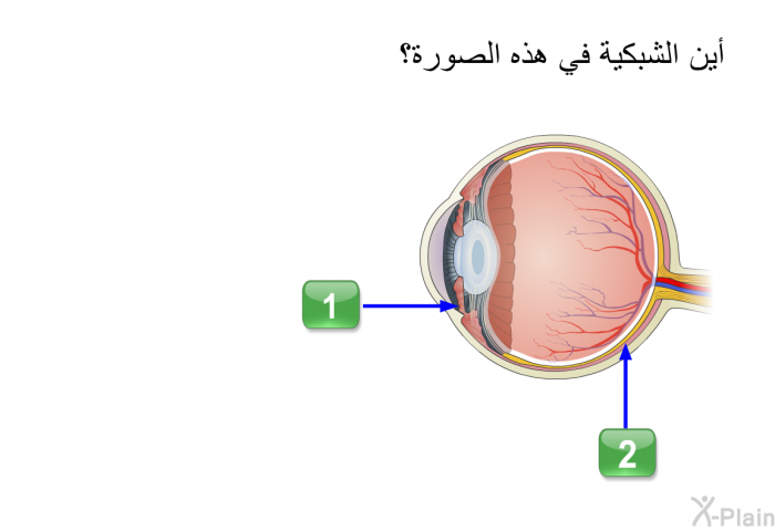 أين الشبكية في هذه الصورة؟