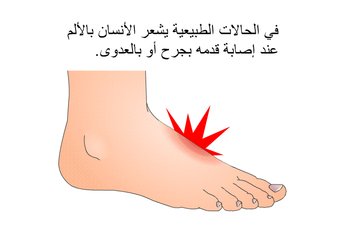 في الحالات الطبيعية يشعر الأنسان بالألم عند إصابة قدمه بجرح أو بالعدوى<B>. </B>
