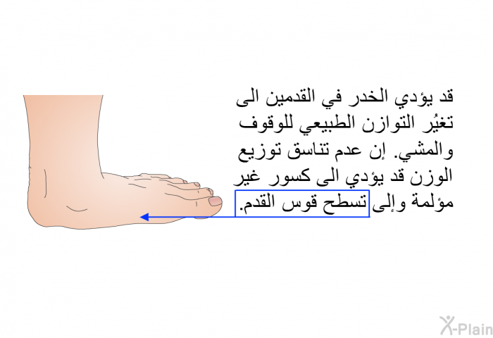 قد يؤدي الخدر في القدمين الى تغيُر التوازن الطبيعي للوقوف والمشي<B>. </B>إن عدم تناسق توزيع الوزن قد يؤدي الى كسور غير مؤلمة وإلى تسطح قوس القدم<B>.</B>