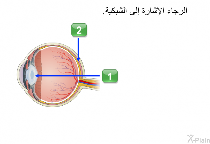 الرجاء الإشارة إلى الشبكية.