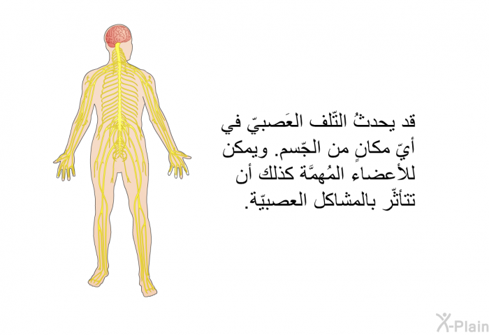 قد يحدثُ التّلف العَصبيّ في أيّ مكانٍ من الجّسم. ويمكن للأعضاء المُهمَّة كذلك أن تتأثّر بالمشاكل العصبيّة.