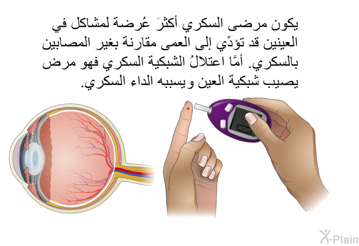 يكون مرضى السكَّري أكثرَ عُرضةً لمشاكل في العينين قد تؤدِّي إلى العمى مقارنة بغير المصابين بالسكري. أمَّا اعتلالُ الشبكية السُّكَّريُّ فهو مرضٌ يصيب شبكية العين ويسبِّبه الدَّاءُ السكَّري.