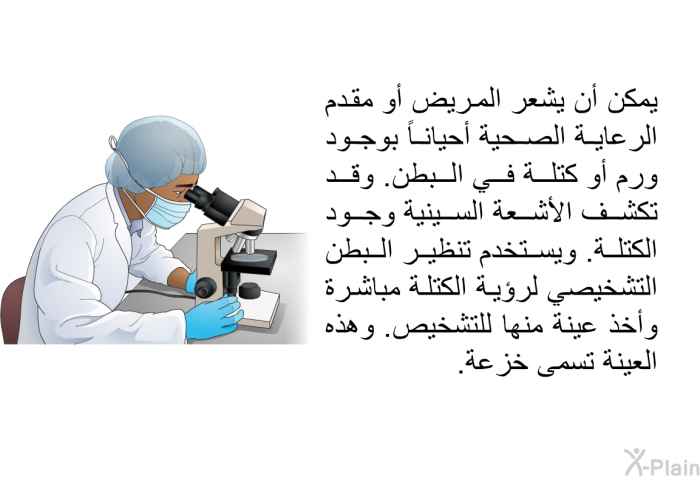 يمكن أن يشعر المريض أو مقدم الرعاية الصحية أحياناً بوجود ورم أو كتلة في البطن. وقد تكشف الأشعة السينية وجود الكتلة. ويستخدم تنظير البطن التشخيصي لرؤية الكتلة مباشرة وأخذ عينة منها للتشخيص. وهذه العينة تسمى خزعة.