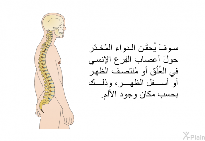 سوفَ يُحقَن الدواء المُخدّر حولَ أعصاب الفِرع الإنسي في العُنُق أو مُنتصف الظهر أو أسفل الظهر، وذلك بحسب مكان وجود الألم.