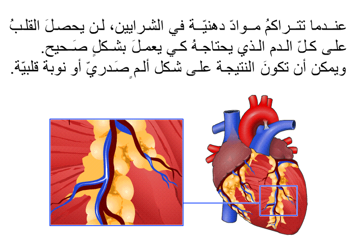 عندما تتراكمُ موادّ دهنيّة في الشرايين، لن يحصلَ القلبُ على كلّ الدم الذي يحتاجهُ كي يعملَ بشكلٍ صَحيح. ويمكن أن تكونَ النتيجة على شكل ألمٍ صَدريّ أو نوبة قلبيّة.