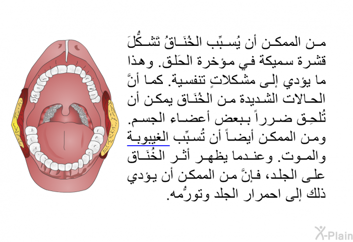 من الممكن أن يُسبِّب الخُنَاقُ تَشكُّلَ قشرة سميكة في مؤخرة الحَلق. وهذا ما يؤدي إلى مشكلاتٍ تنفسية. كما أنَّ الحالات الشديدة من الخُنَاق يمكن أن تُلحِق ضرراً ببعض أعضاء الجسم. ومن الممكن أيضاً أن تُسبِّب الغيبوبة والموت. وعندما يظهر أثر الخُنَاق على الجلد، فإنَّ من الممكن أن يؤدي ذلك إلى احمرار الجلد وتورُّمه.