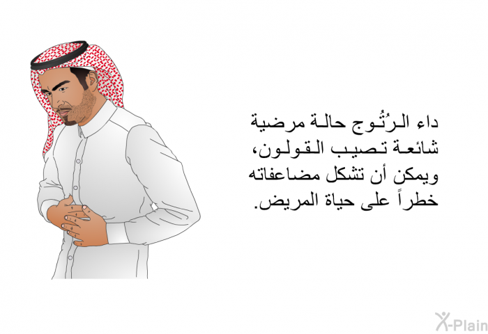 داء الرُتُوج حالة مرضية شائعة تصيب القولون، ويمكن أن تشكل مضاعفاته خطراً على حياة المريض.