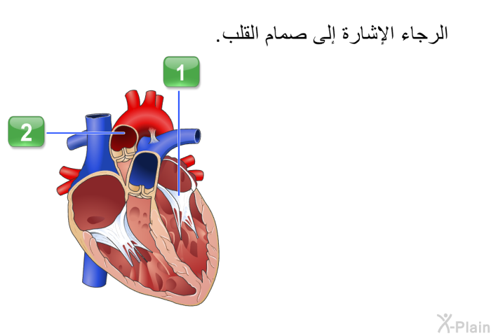 الرجاء الإشارة إلى صمام القلب.