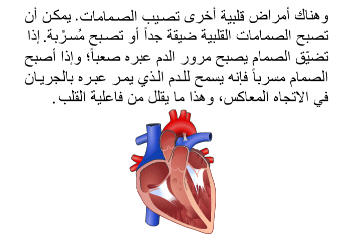 وهناك أمراض قلبية أخرى تصيب الصمامات. يمكن أن تصبح الصمامات القلبية ضيقة جداً أو تصبح مُسرِّبة. إذا تضّيق الصمام يصبح مرور الدم عبره صعباً؛ وإذا أصبح الصمام مسرباً فإنه يسمح للدم الذي يمر عبره بالجريان في الاتجاه المعاكس، وهذا ما يقلل من فاعلية القلب.
