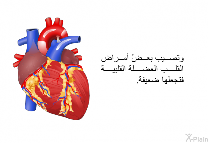 وتصيب بعضُ أمراض القلب العضلةَ القلبيةَ فتجعلها ضعيفة.