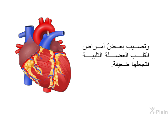 وتصيب بعضُ أمراض القلب العضلةَ القلبيةَ فتجعلها ضعيفة.