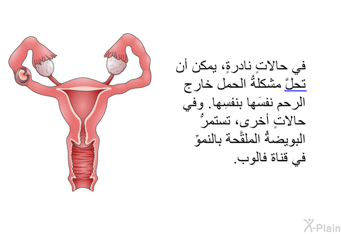 في حالاتٍ نادرةٍ، يمكن أن تحلَّ مشكلةُ الحمل خارج الرحم نفسَها بنفسِها. وفي حالاتٍ أخرى، تستمرُّ البويضةُ الملقَّحة بالنموِّ في قناة فالوب.