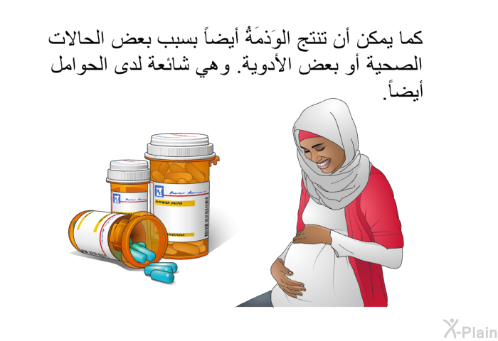 كما يمكن أن تنتج الوَذمَةُ أيضاً بسبب بعض الحالات الصحية أو بعض الأدوية. وهي شائعة لدى الحوامل أيضاً.
