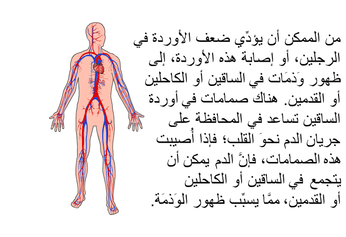 من الممكن أن يؤدِّي ضعف الأوردة في الرجلين، أو إصابة هذه الأوردة، إلى ظهور وَذمَات في الساقين أو الكاحلين أو القدمين. هناك صمامات في أوردة الساقين تساعد في المحافظة على جريان الدم نحوَ القلب؛ فإذا أُصيبت هذه الصمامات، فإنَّ الدم يمكن أن يتجمع في الساقين أو الكاحلين أو القدمين، ممَّا يسبِّب ظهور الوَذمَة.