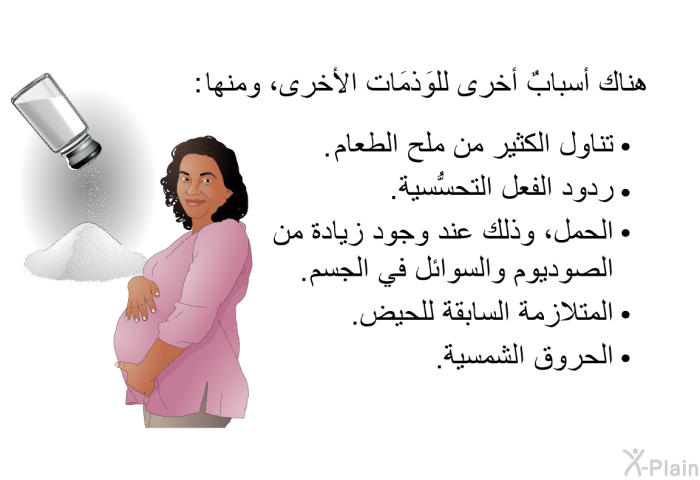 هناك أسبابٌ أخرى للوَذمَات الأخرى، ومنها:   تناول الكثير من ملح الطعام.  ردود الفعل التحسُّسية.  الحمل، وذلك عند وجود زيادة من الصوديوم والسوائل في الجسم.  المتلازمة السابقة للحيض. الحروق الشمسية.