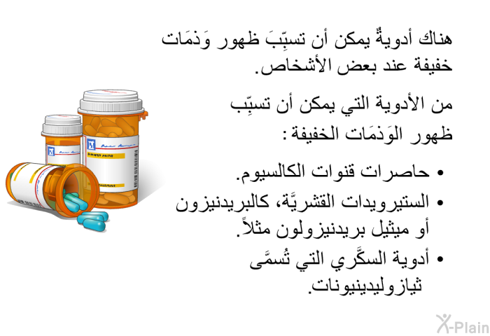 هناك أدويةٌ يمكن أن تسبِّبَ ظهور وَذمَات خفيفة عند بعض الأشخاص. من الأدوية التي يمكن أن تسبِّب ظهور الوَذمَات الخفيفة:   حاصرات قنوات الكالسيوم.  الستيرويدات القشريَّة، كالبريدنيزون أو ميثيل بريدنيزولون مثلاً. أدوية السكَّري التي تُسمَّى "ثيازوليدينيونات".