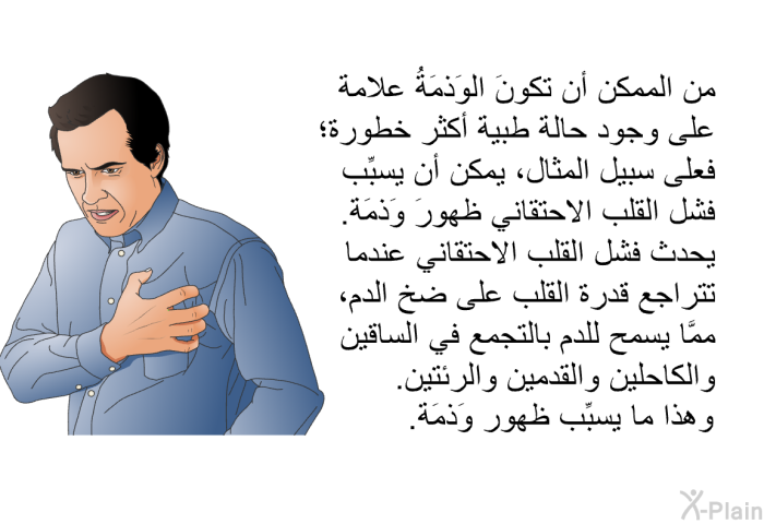 من الممكن أن تكونَ الوَذمَةُ علامة على وجود حالة طبية أكثر خطورة؛ فعلى سبيل المثال، يمكن أن يسبِّب فشل القلب الاحتقاني ظهورَ وَذمَة. يحدث فشل القلب الاحتقاني عندما تتراجع قدرة القلب على ضخ الدم، ممَّا يسمح للدم بالتجمع في الساقين والكاحلين والقدمين والرئتين. وهذا ما يسبِّب ظهور وَذمَة.