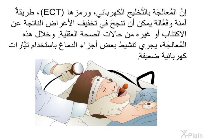 إنَّ المُعالجَة بالتَّخليج الكهربائي، ورمزها (ECT)، طريقةٌ آمنة وفَعَّالة يمكن أن تنجحَ في تخفيف الأعراض الناتجة عن الاكتئاب أو غيره من حالات الصحة العقلية. وخلال هذه المُعالجَة، يجري تنشيط بعض أجزاء الدماغ باستخدام تيَّارات كهربائية ضعيفة.