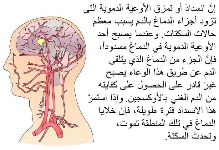 إنَّ انسدادَ أو تمزق الأوعية الدموية التي تزود أجزاء الدماغ بالدم يسبب معظمَ حالات السكتات. وعندما يصبح أحد الأوعية الدموية في الدماغ مسدوداً، فإنَّ الجزء من الدماغ الذي يتلقى الدم عن طريق هذا الوعاء يصبح غيرَ قادر على الحصول على كفايته من الدم الغني بالأوكسجين. وإذا استمرَّ هذا الانسداد فترة طويلة ، فإن خلايا الدماغ في تلك المنطقة تموت، وتحدث السكتة.