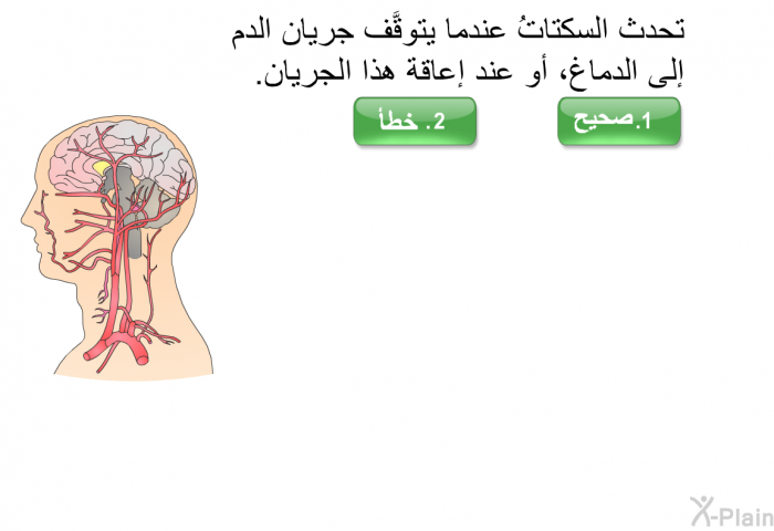 تحدث السكتاتُ عندما يتوقَّف جريان الدم إلى الدماغ، أو عند إعاقة هذا الجريان.