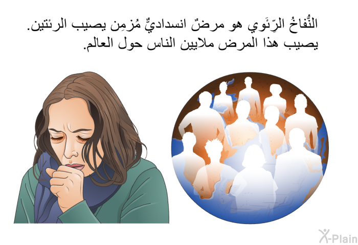 النُّفاخُ الرِّئَوي هو مرضٌ انسداديٌّ مُزمِن يصيب الرئتين. يصيب هذا المرض ملايين الناس حول العالم.