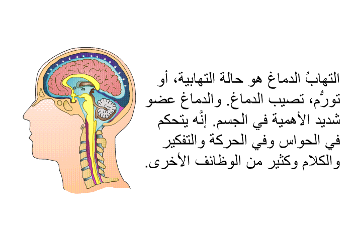 التهابُ الدماغ هو حالةٌ التهابية، أو تورُّم، تصيب الدماغ. والدماغُ عضوٌ شديد الأهمية في الجسم. إنَّه يتحكَّم في الحواس وفي الحركة والتفكير والكلام وكثير من الوظائف الأخرى.