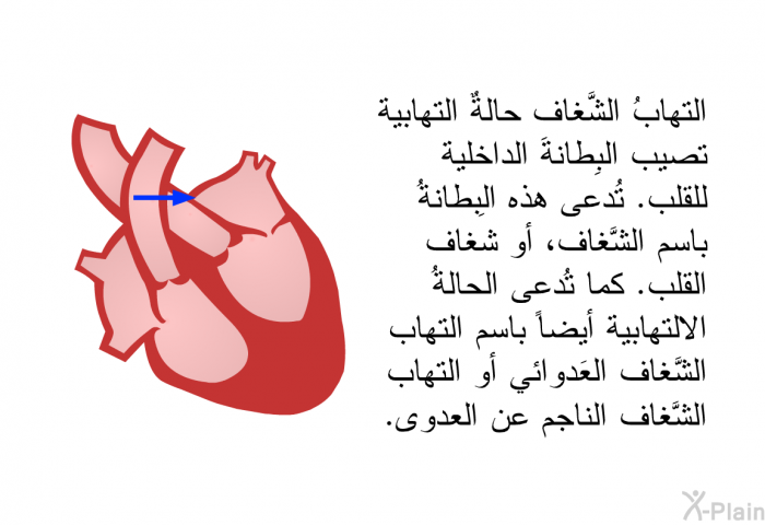 التهابُ الشَّغاف حالةٌ التهابية تصيب البِطانةَ الداخلية للقلب. تُدعى هذه البِطانةُ باسم الشَّغاف، أو شَغاف القلب. كما تُدعى الحالةُ الالتهابية أيضاً باسم التهاب الشَّغاف العَدوائي أو التهاب الشَّغاف الناجم عن العدوى.