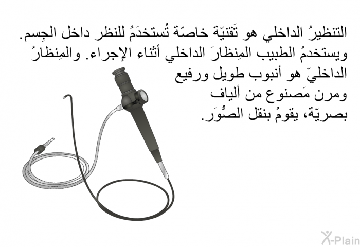 التنظيرُ الداخلي هو تَقنيّة خاصّة تُستخدَمُ للنظر داخل الجِسم. ويستخدمُ الطبيب المِنظارَ الداخلي أثناء الإجراء. والمِنظارُ الداخليّ هو أنبوب طويل ورفيع ومرن مَصنوع من ألياف بصريّة، يقومُ بنقل الصُّوَر.