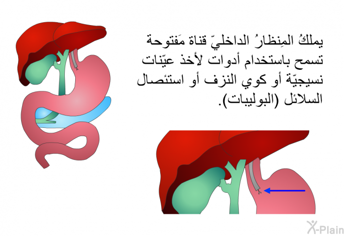 يملكُ المِنظارُ الداخليّ قناة مَفتوحة تسمح باستخدام أدوات لأخذ عيّنات نسيجيّة أو كوي النزف أو استئصال السلائل (البوليبات).