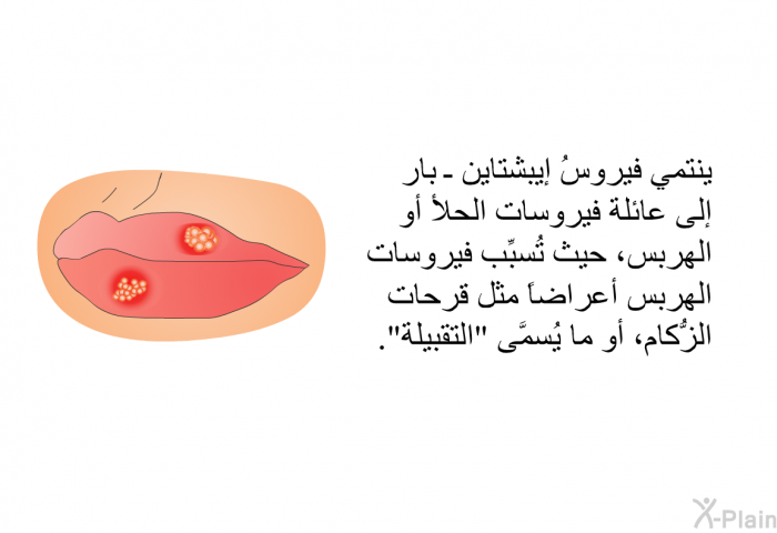 ينتمي فيروسُ إيبشتاين ـ بار إلى عائلة فيروسات الحلأ أو الهربس، حيث تُسبِّب فيروساتُ الهربس أعراضاً مثل قرحات الزُّكام، أو ما يُسمَّى "التقبيلة".