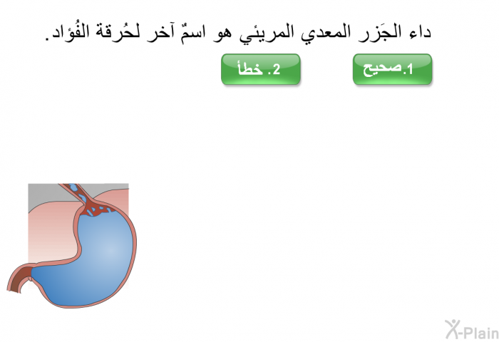 داء الجَزر المعدي المريئي هو اسمٌ آخر لحُرقة الفُؤاد.
